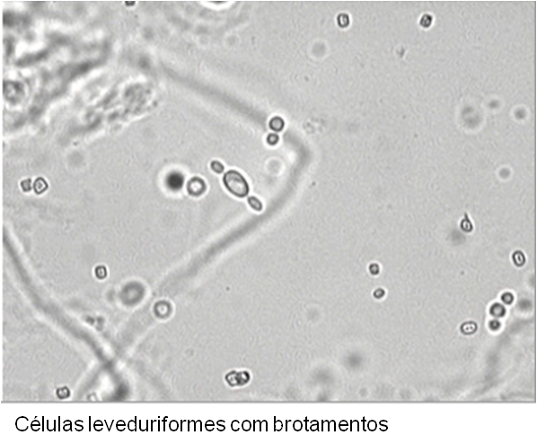 Células Leveduriformes Tratamento: O Que Fungo Pode Causar?